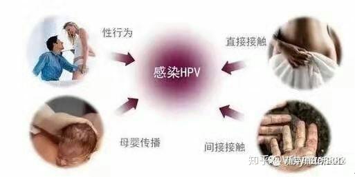 HPV病毒最新治疗方法研究与应用进展